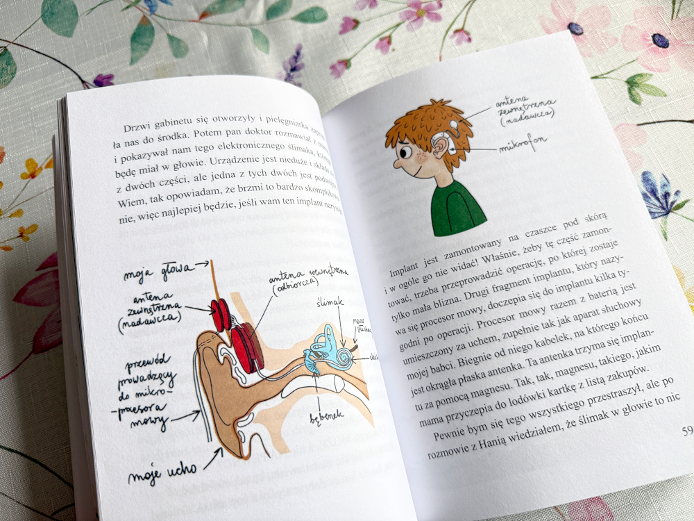 Ilustracja ucha z zaznaczonym implantem słuchowym oraz opisem elementów urządzenia na stronie książki